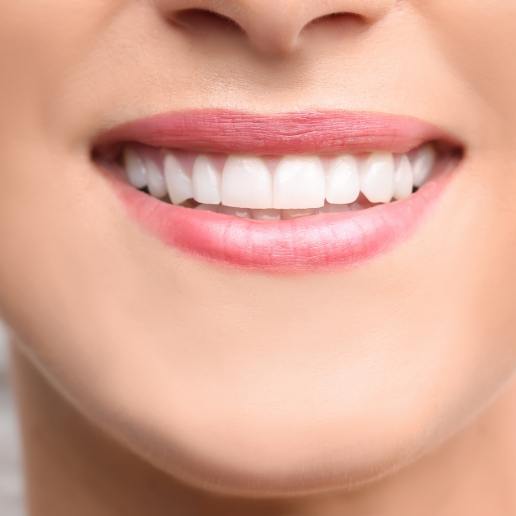 Close up of a smile with white teeth and even gums