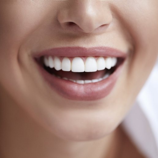 Close up of a woman with straight white teeth smiling