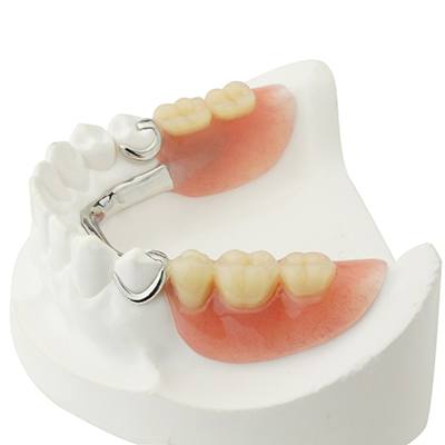 Examples of different dentures at United Dental Centers of Merrillville