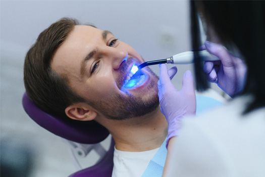 UV light applied to man’s tooth-colored filling