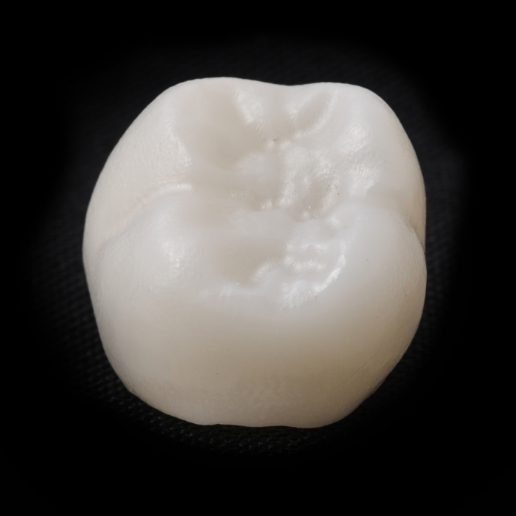 Lifelike dental crown in Merrillville