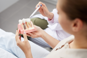 a closeup of a dental implant model 