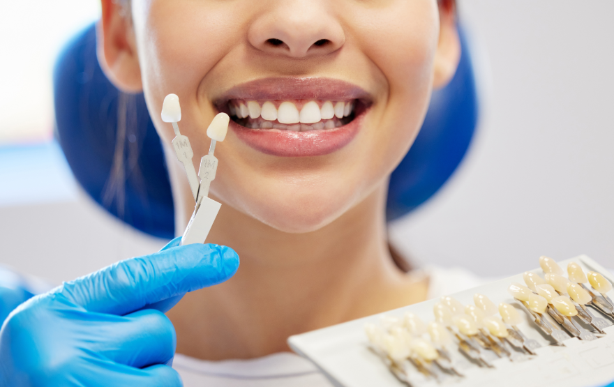 Woman holding up veneers
